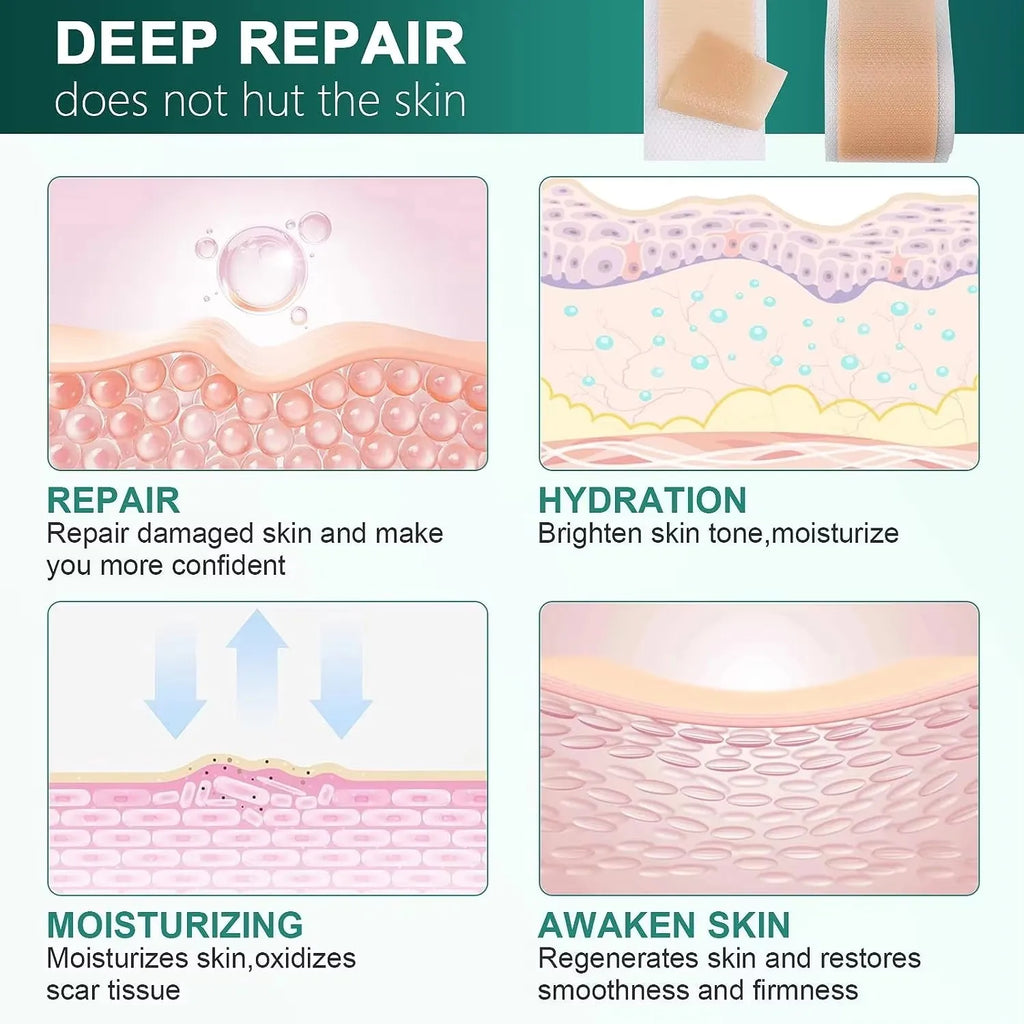 Silicone Scar Repair Patch Kit