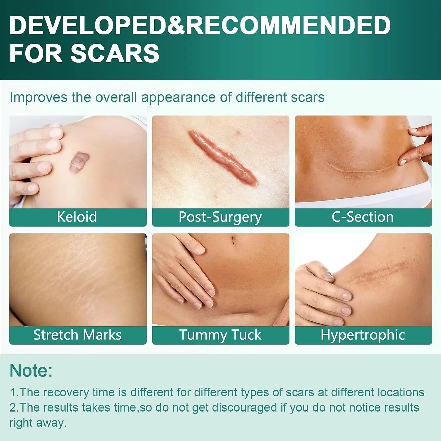 Silicone Scar Repair Patch Kit