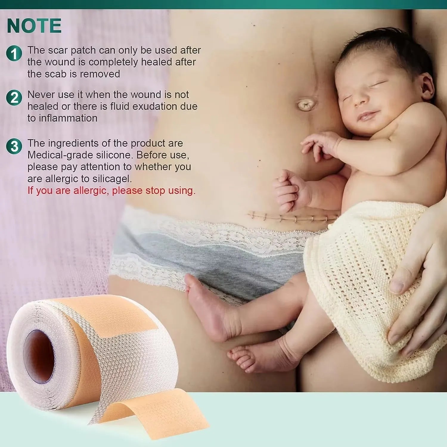 Silicone Scar Repair Patch Kit